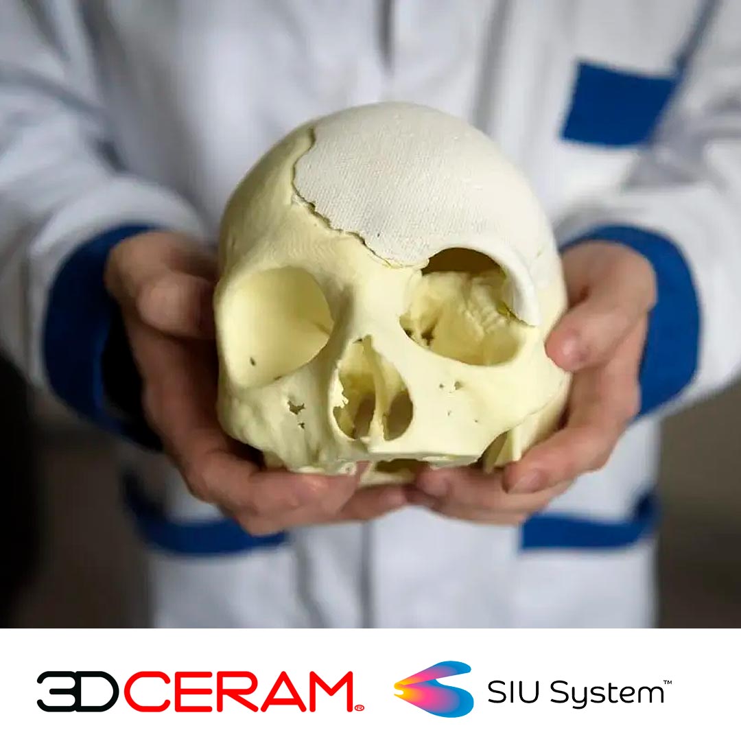 Вебинар "Напечатан на 3D-принтере и вживлен, история первого керамического черепного имплантата" от компании 3DCeram